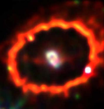 No core remnant. SN 1987A is evolving fast!