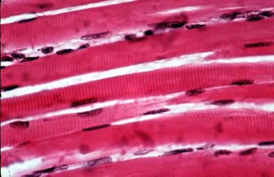 Skeletal Muscle Cells They have a long and fibre-like appearance.