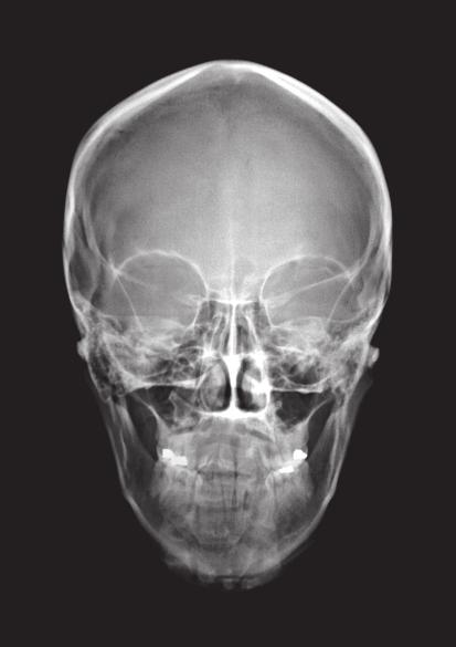 2 Answer all questions in the spaces provided. 1 Figure 1 shows an X-ray image of a human skull. Figure 1 1 (a) Use the correct answers from the to complete the sentence.