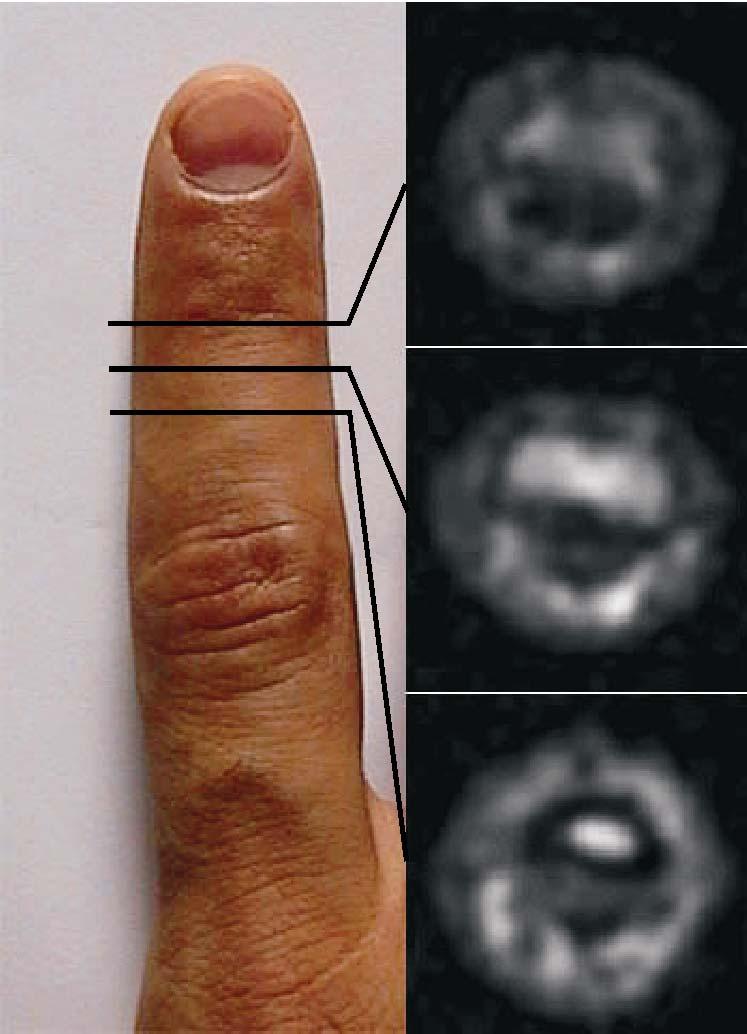 in vivo imaging of a human finger The most important target of this project is to use the open tomograph to image biological
