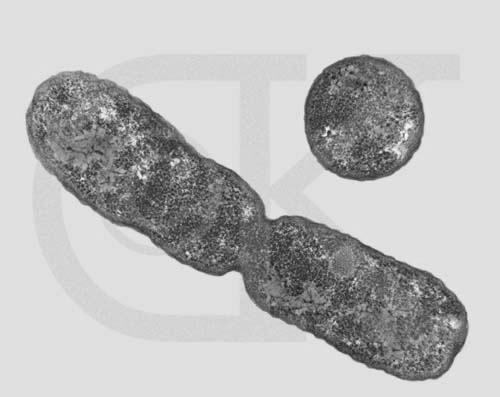 Rod-Shaped Bacterium, E. coli, dividing by binary fission. BUDDING A less common form of asexual reproduction among bacteria is budding.