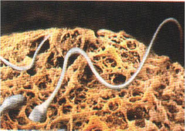 microtubules Cilia-short,