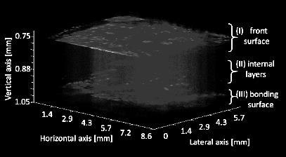 To validate the vibration measurements using WHIV, a 3D OCT image of the fixed kidney was measured again to fix the target layers (region I, II, and III in Fig.2) for measuring the surface vibration.