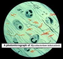 Domain Bacteria Eubacteria are prokaryotes whose cell walls contain peptidoglycan.