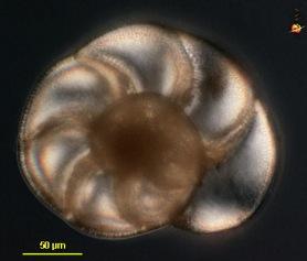 testate ameobas = with shells), including radiolarians, forams, and cercozoans Amoebas