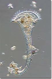 They make up zooplankton and form the basis of the food chain in aquatic environments. They can cause diseases such as.