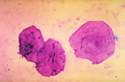 c. These round human cells are unusual because they do not have a nucleus.