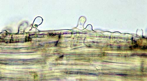 with Figure 34. Takakia lepidozioides mucous cells on stem.