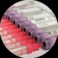 vials. In addition, sample trays and agitators are available for vial sizes from 2 to 100 ml.