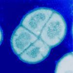 withstand almost anything: Deinococcus Radiodurans Listed in