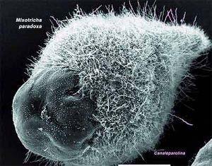 Pelomyxa palustris! Single cell with nucleus but no Golgi, E.R.
