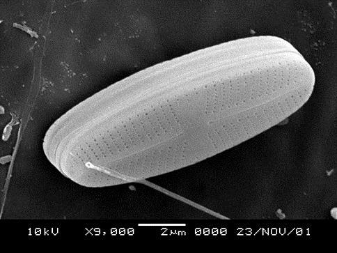 beam of electrons Diatom Sea urchin sperm An electron detector produces a 3 -dimensional