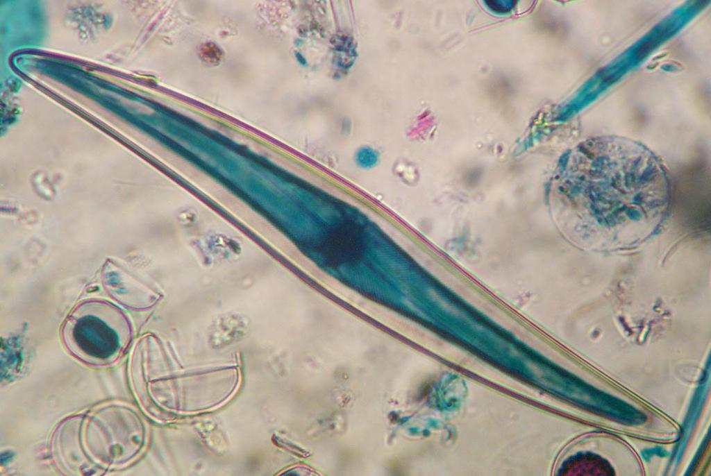 Blooms DIATOMS Phylum Bascillariophyta Occur in favorable conditions such as adequate nutrition and light Normally spring and fall due to overturn (upwellings) Some contain a toxin called domoic acid