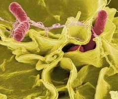 Kingdom Monera Bacteria Common bacteria Prokaryotes Strep throat Anthrax Chlamydia E.