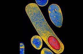 SPORE FORMATION SOME BACTERIA CAN TRANSFORM INTO A DORMANT STATE CALLED AN ENDOSPORE IT ALLOWS BACTERIA TO SURVIVE DIFFICULT CONDITIONS BACTERIA FORM A