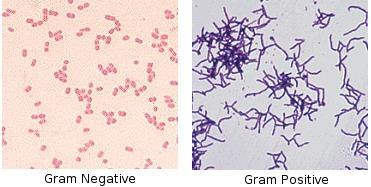 Gram staining process helps