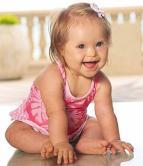 Down Syndrome (Trisomy 21) Non-disjunction can cause Down syndrome and other