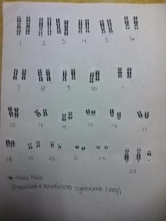 KARYOTYPING ACTIVITY Map each karyotype and determine if it is male or female? What is its genetic disorder?