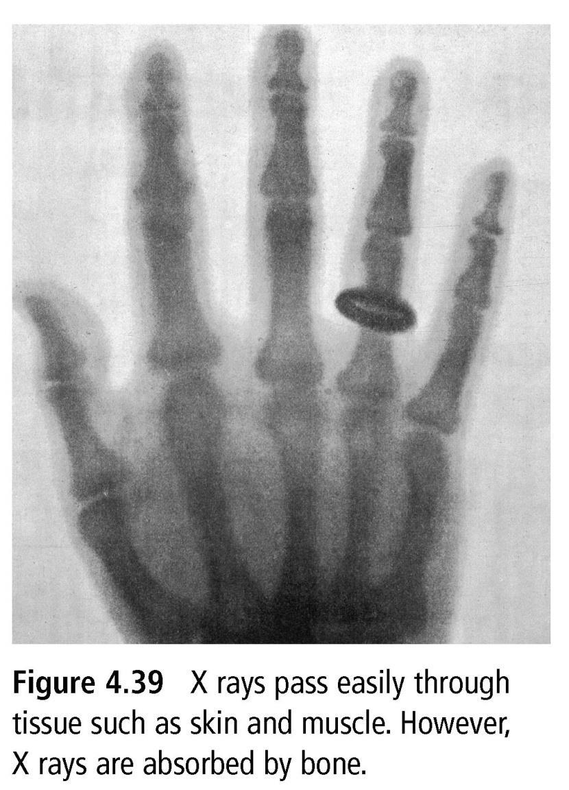 6. X-Rays Compared to visible light: Shorter