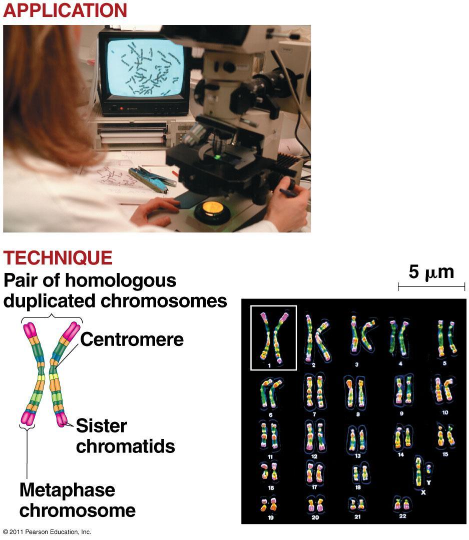 Karyotype: Homologous chromosomes