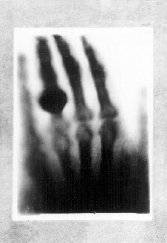 2. The photographs show two X-ray images.
