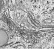 Organelles & Internal membranes Eukaryotic cell