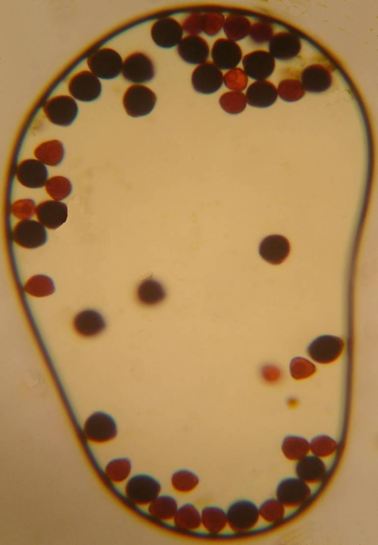 Soybean M-type male sterility was defined as gametophyte sterility.