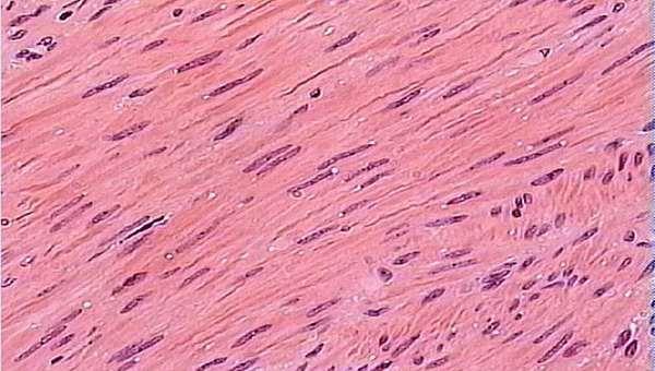 skeletal muscle, cardiac muscle, and smooth muscle.