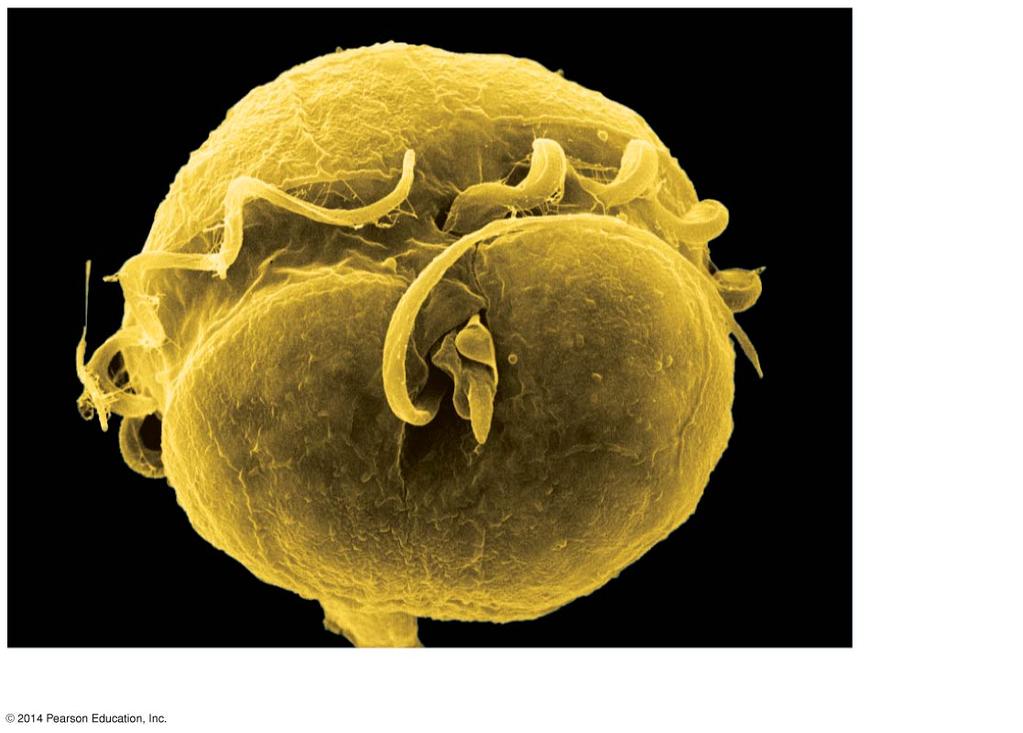 Flagella 3 µm Pfiesteria