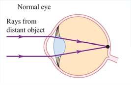 Near point: Closest distance to the eye at which