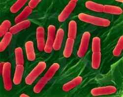 Cell Type Prokaryotes Bacteria DO NOT