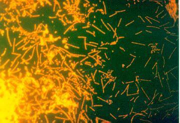 Kingdoms of Bacteria Eubacteria Contains all prokaryotes except