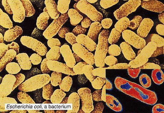 Eubacteria some cause human diseases