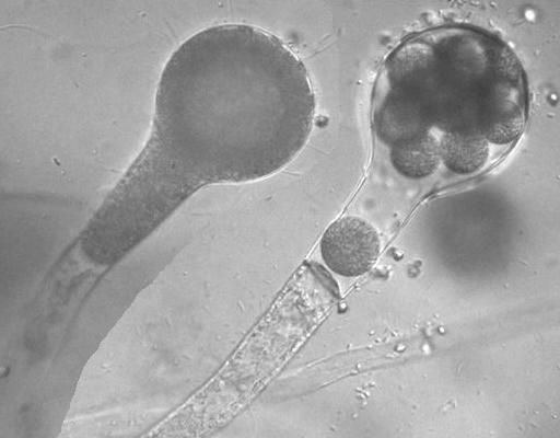 Oomycetes - the water molds Stramenopiles were those organisms that are united by presence of two flagella (biflagellates) of unequal length, form or movement (heterokonts).