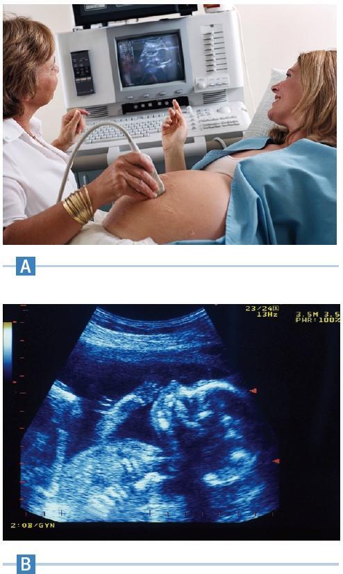 Lecture 14 37/38 Phys 220 Ultrasound Images Ultrasonic imaging uses sound waves to obtain images inside a material The most familiar use is to produce views inside the human