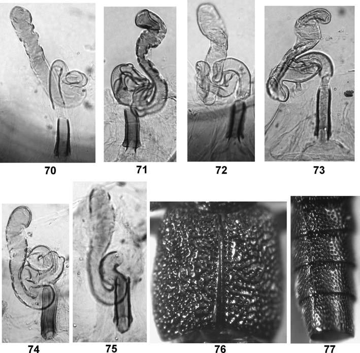 1474 Figs 70-77: Spermathecae of PTT (70-75), elytra (76), semilateral aspect of abdominal segments 4-7 (77) of Stenus permolestus nov.sp. (70, T 116), S. pertricosus nov.sp. (71, T 61), S.