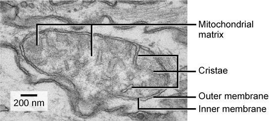 Treponema pallidum spirochetes as seen under dark field microscope,
