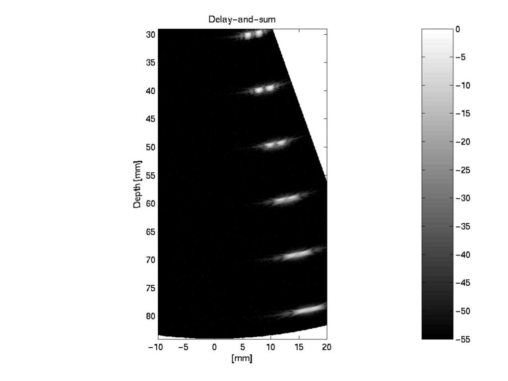 INF540 202 Adaptive beamforming p7 Slide 5: Example: Ultrasound imaging Experimental
