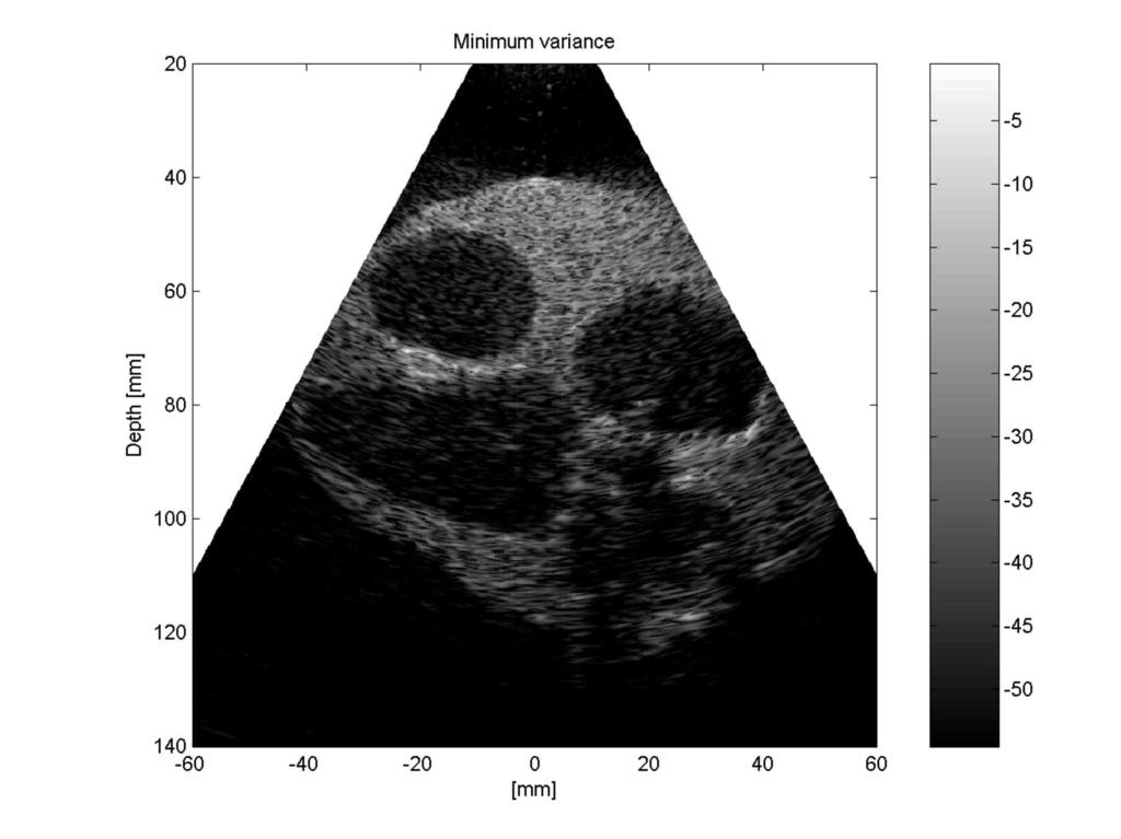 INF540 202 Adaptive beamforming p8 Slide 7: Example: Ultrasound imaging, continued Experimental data, heart phantom