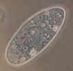 The protists form a group of organisms that really do not fit into any other kingdom.
