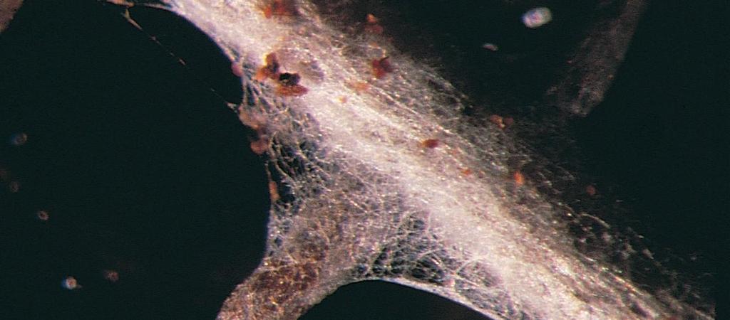 young root fungal hyphae A Mycorrhiza formed by a