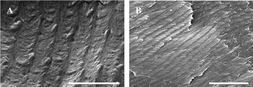 Figure S3. Scanning electron microscopy (SEM) images of the CNMP-Au composite film. A) Scale bar = 1 μm, B) Scale bar = 2 μm.