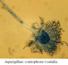 Asexual Spores The Conidiophores look like tubes the