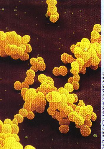 Staphylo - bacteria occur in clumps, such as this
