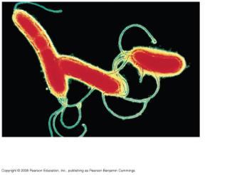 larger bacterium (colorized TEM) Fig.