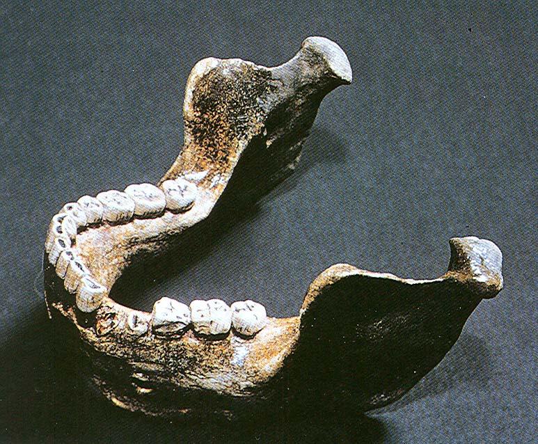 The Heidelberg jaw or the Mauer Mandible
