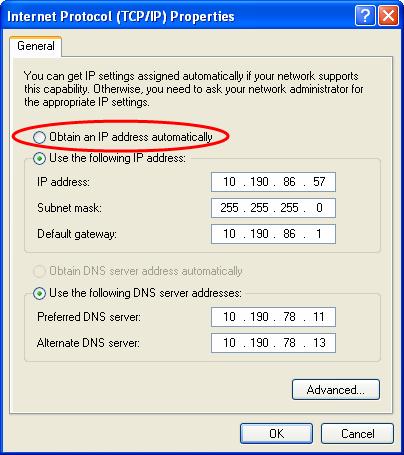 1. Select TCP/IP from the network components list and click Properties. 2. Contact your Network Administrator (or whoever assigns IP addresses in your network) to get the appropriate address.