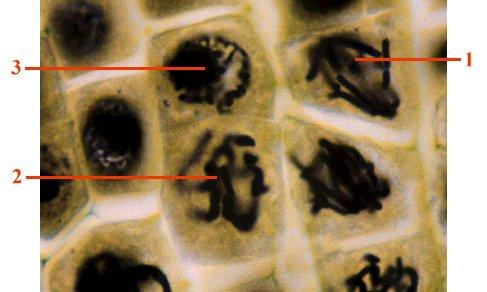 Information : The photomicrograph below shows some plant