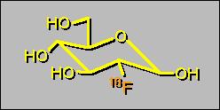Fluorodeoxyglucose - FDG - small organic molecule behaving like glucose -