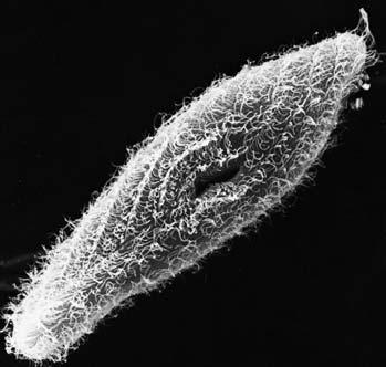 3) Ciliates ( 섬모충류 ) - extremely diverse heterotrophic protozoa - size : 10μm ~ 3mm, 9+2 arranged hairlike cilia